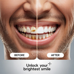 DailyNeedDeals™ Care X-18 Electric Brush Electric Toothbrush  (Black)